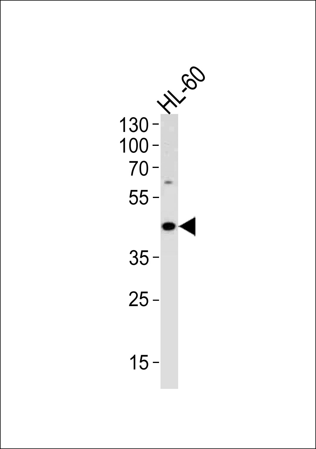 ADA Antibody