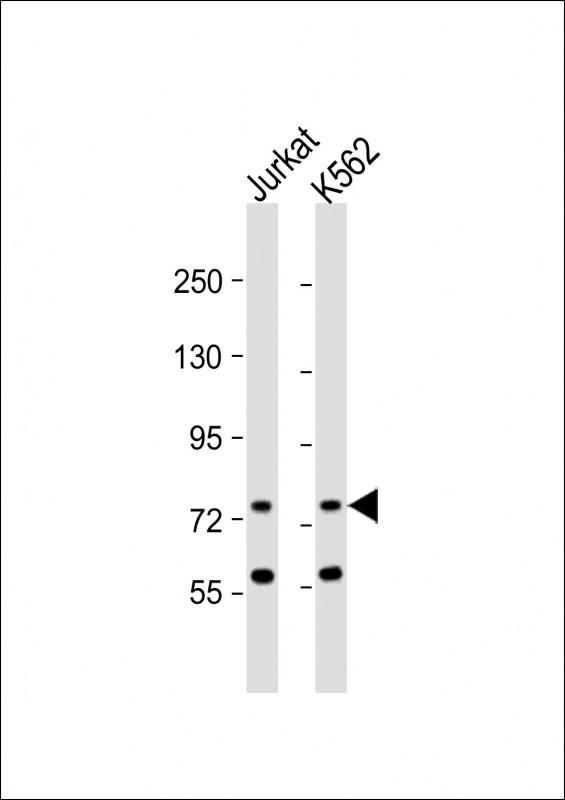 ATG16L2 Antibody