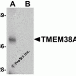 Western blot analysis of TMEM38A in rat skeletal muscle tissue lysate with TMEM38A antibody at 1 μg/mL in (A) the absence and (B) the presence of blocking peptide.