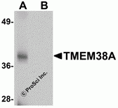 TMEM38A Peptide