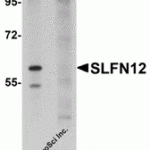 Western blot analysis of SLFN12 in SK-N-SH cell lysate with SLFN12 antibody at 1 μg/mL in (A) the absence and (B) the presence of blocking peptide.
