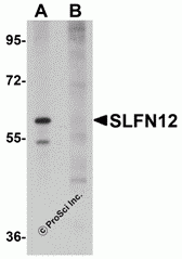 SLFN12 Peptide