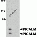 Western blot analysis of PICALM in EL4 cell lysate with PICALM antibody at 1 μg/mL in (A) the absence and (B) the presence of blocking peptide.