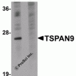 Western blot analysis of TSPAN9 in EL4 cell lysate with TSPAN9 antibody at 1 μg/mL in (A) the absence and (B) the presence of blocking peptide.