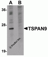 TSPAN9 Peptide