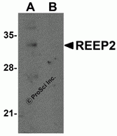 REEP2 Peptide