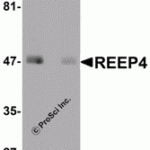 Western blot analysis of REEP4 in human lung tissue lysate with REEP4 antibody at 1 µg/mL in (A) the absence and (B) the presence of blocking peptide.