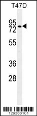 ZNF69 Antibody