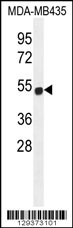 ZNF286B Antibody