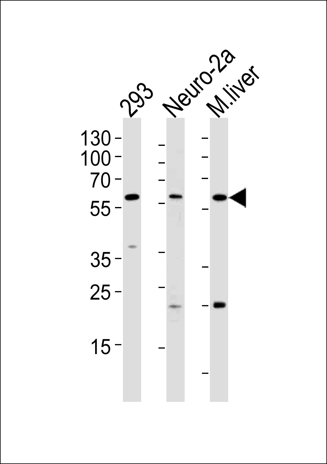 CCDC36 Antibody