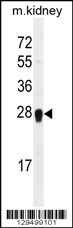 ARL5C Antibody