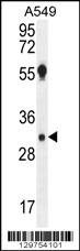 AQP12B Antibody
