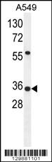 ANKRD58 Antibody