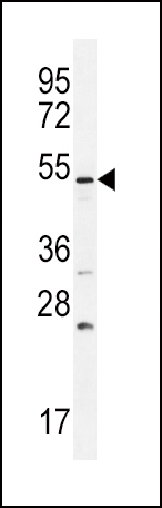 BMPR1B Antibody
