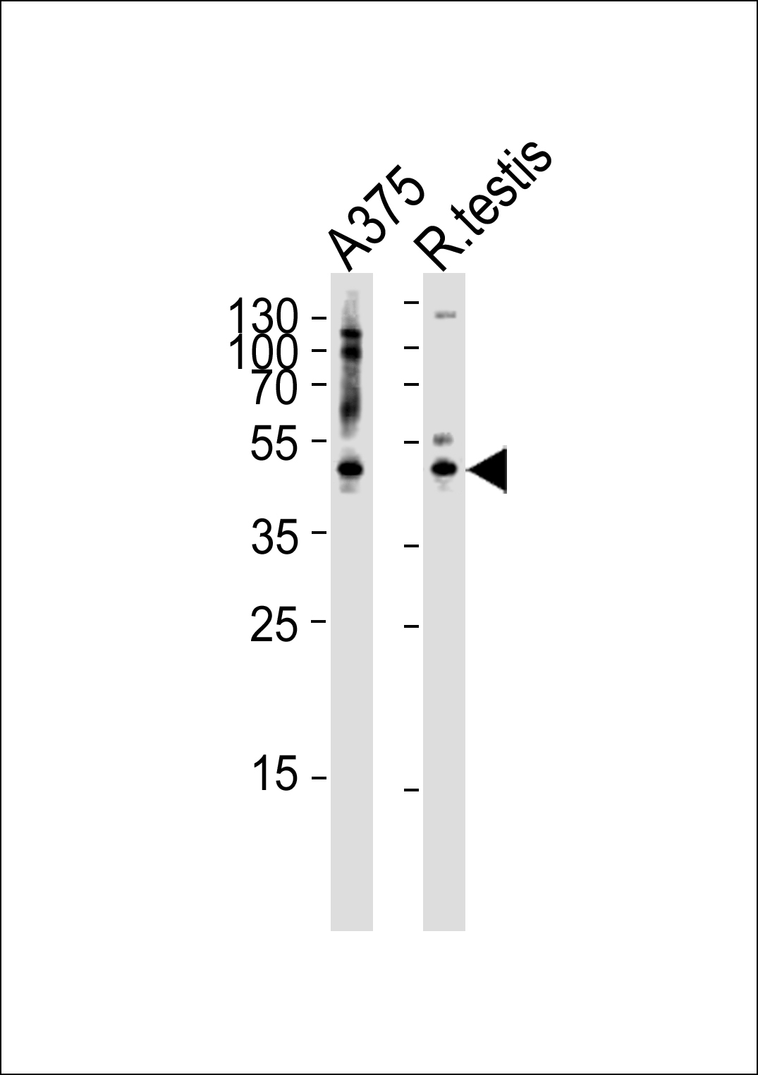 AP1M1 Antibody