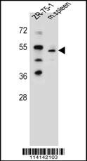 TBX6 Antibody