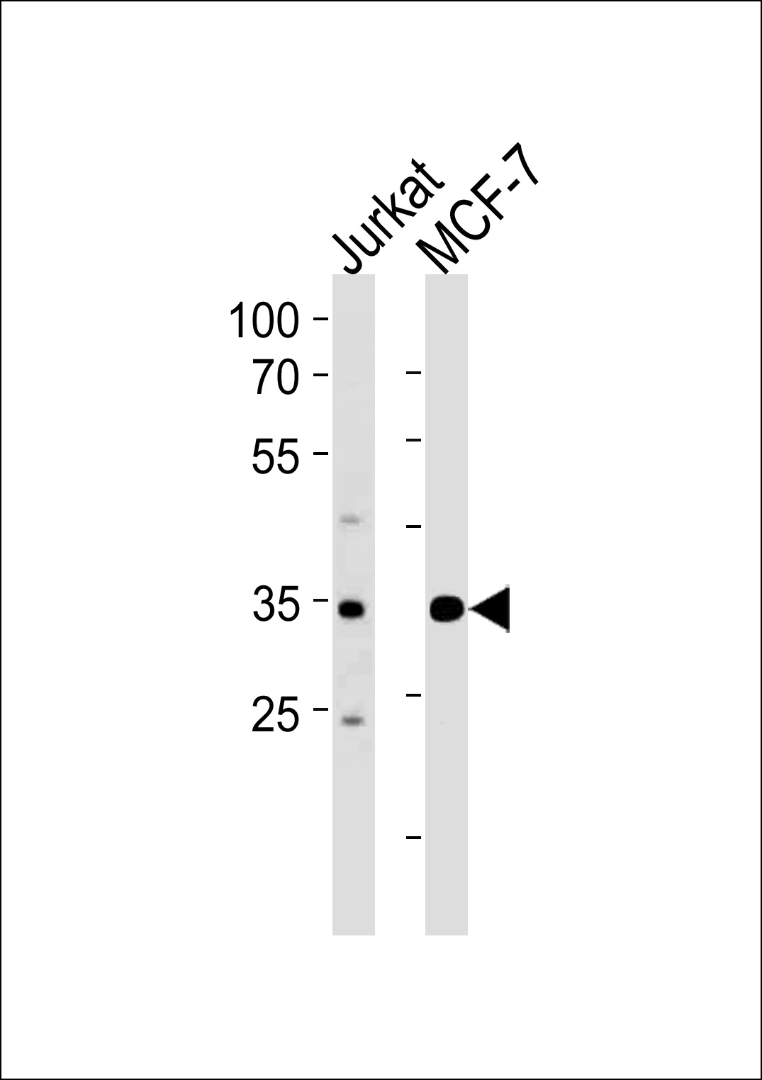 ATF4 Antibody