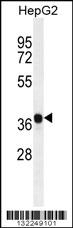 AKR1C2 Antibody