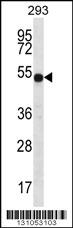 ATP6V1B1 Antibody