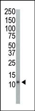Ubiquitin Antibody
