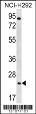 AQP5 Antibody