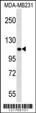 ACTN3 Antibody