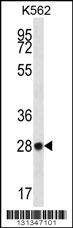 ZNF146 Antibody