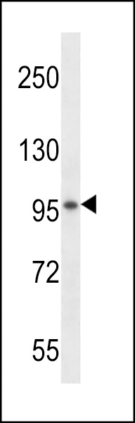 VSGP/F-spondin Antibody
