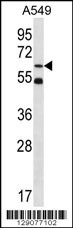 ZNF248 Antibody
