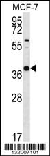YIF1B Antibody
