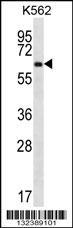 ZNF623 Antibody