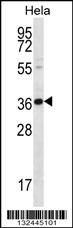 BTG3 Antibody