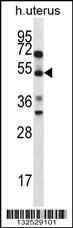 ABRA Antibody