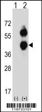 BCAT2 Antibody