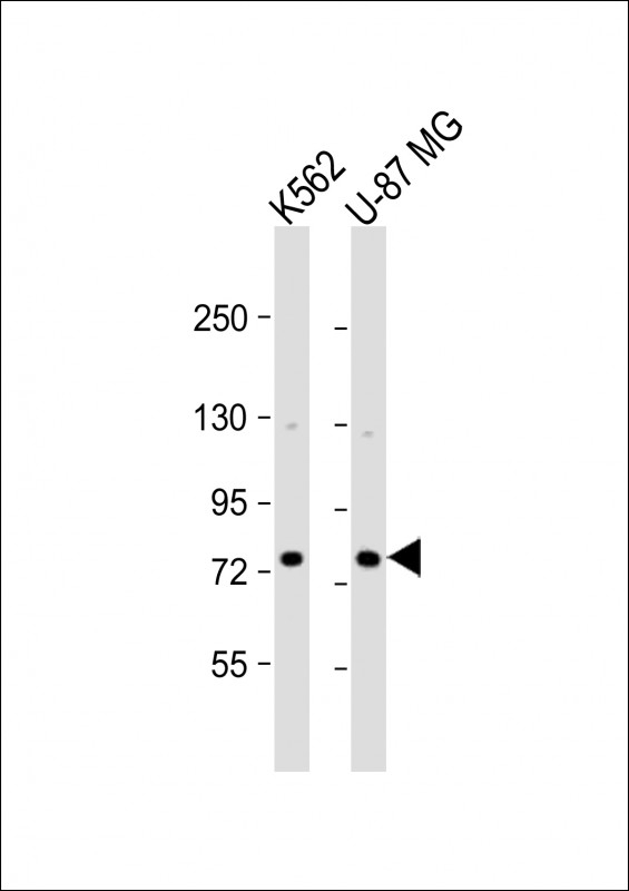 ARHGAP22 Antibody