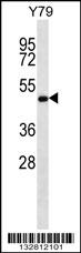ZFYVE19 Antibody