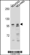 AR Antibody