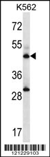 ADSS Antibody