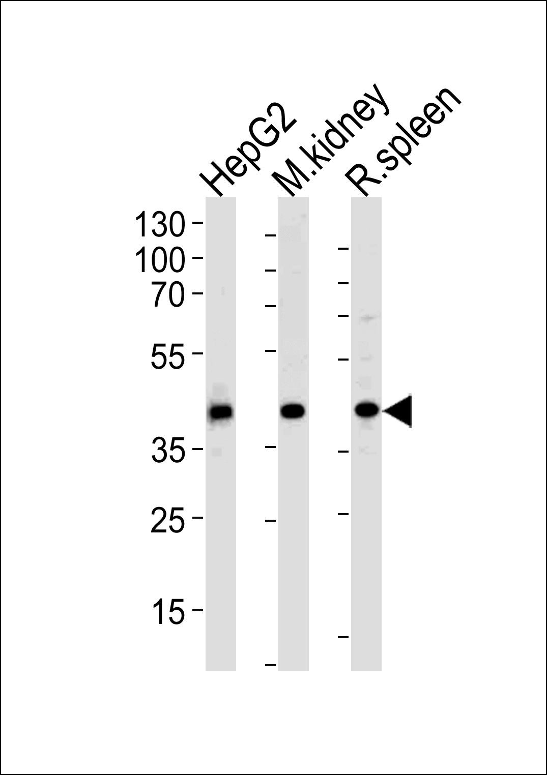 ACADL Antibody