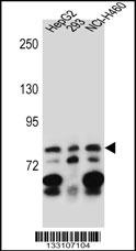 ZNF555 Antibody