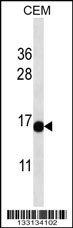 ATAD4 Antibody