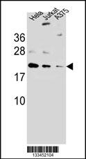 ARL6IP6 Antibody