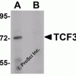 Western blot analysis of TCF3 in Human brain tissue lysate with TCF3 antibody at 1 μg/mL in (A) the absence and (B) presence of peptide blocking.