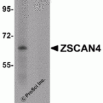 Western blot analysis of ZSCAN4 in mouse lung tissue lysate with ZSCAN4 antibody in (A) the absence and (B) presence of peptide blocking.
