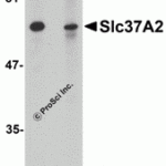 Western blot analysis of Slc37A2 in mouse spleen tissue lysate with Slc37A2 antibody at 1 μg/mL in the (A) absence and (B) presence of blocking peptide.