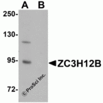 Western blot analysis of ZC3H12B in mouse brain tissue lysate with ZC3H12B antibody at 1 μg/mL in (A) the absence and (B) the presence of blocking peptide.