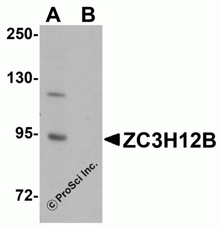 ZC3H12B Peptide