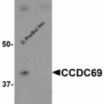 Western blot analysis of CCDC69 in mouse lung tissue lysate with CCDC69 antibody at 1 μg/mL in (A) the absence and (B) the presence of blocking peptide.