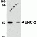 Western blot analysis of ENC-2 in Jurkat cell lysate with ENC-2 antibody at 1 μg/mL in (A) the absence and (B) the presence of blocking peptide.