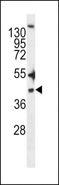 ZDHHC20 Antibody